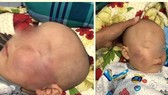 Cho thôi việc bảo mẫu tát bé trai 19 tháng tuổi đến sưng mặt