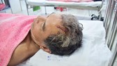 Chủ tịch UBND tỉnh Thừa Thiên – Huế hứa xử nghiêm “cát tặc” chém trọng thương người dân