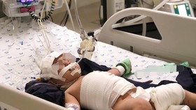 Hiện tại sức khỏe toàn trạng bé đã qua cơn nguy kịch, đang được theo dõi và chăm sóc đặc biệt tại Khoa Hồi sức tích cực.