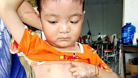 Cháu bé 8 tuổi đang cần sự giúp đỡ