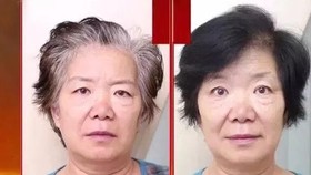 Tóc bạc 10 năm biến thành tóc đen, trị tóc bạc tận gốc!