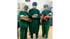 Woman gives birth to triplet in one egg: rare in globe