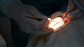 Two blind men can see after corneal graft