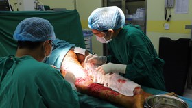 Các bác sĩ đang tiến hành cắt bỏ da bị hoại tử để tránh nhiễm trùng các khu vực lân cận