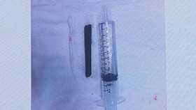 Đoạn đũa dài 7cm được lấy ra thành công
