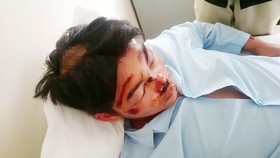 Em T. đang điều trị tại bệnh viện.
