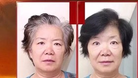Tóc bạc 10 năm biến thành tóc đen, trị tóc bạc tận gốc, giúp tóc đen mọc trở lại!