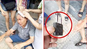 Cụ ông khoảng 70 tuổi bất ngờ bị ổ khóa rơi từ tầng cao chung cư xuống trúng đầu, chảy máu khá nhiều