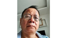 Ông B. bị nhóm thanh niên đánh trọng thương trong quán karaoke