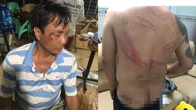 Truy xét nhóm côn đồ vào nhà dân tấn công khiến nhiều người bị thương