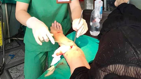 Cụ bà bị 30 vết thương do chó berger cắn phải nhập viện