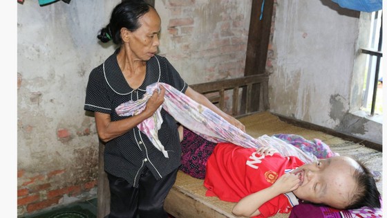Bà Hồng chăm sóc cô con gái khi chào đời chưa được 5 tháng thì bị não úng thủy, nằm liệt giường