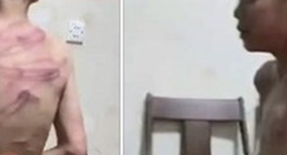 Hình ảnh cháu bé bị đánh lan truyền trên mạng xã hội. Ảnh: Facebook