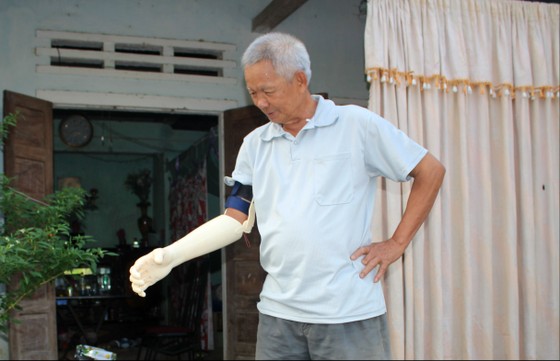 Chàng sinh viên xứ Quảng mang "bàn tay robot" chi phí 3 triệu đồng đến với người khuyết tật nghèo ảnh 2