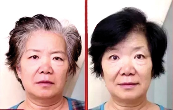 Phương thức mới giúp tóc đen mọc trở lại ảnh 2