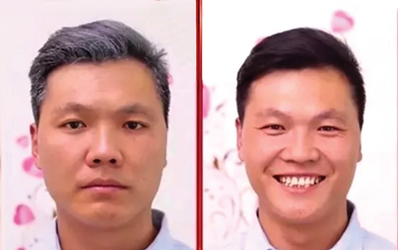 Phương thức mới giúp tóc đen mọc trở lại ảnh 1