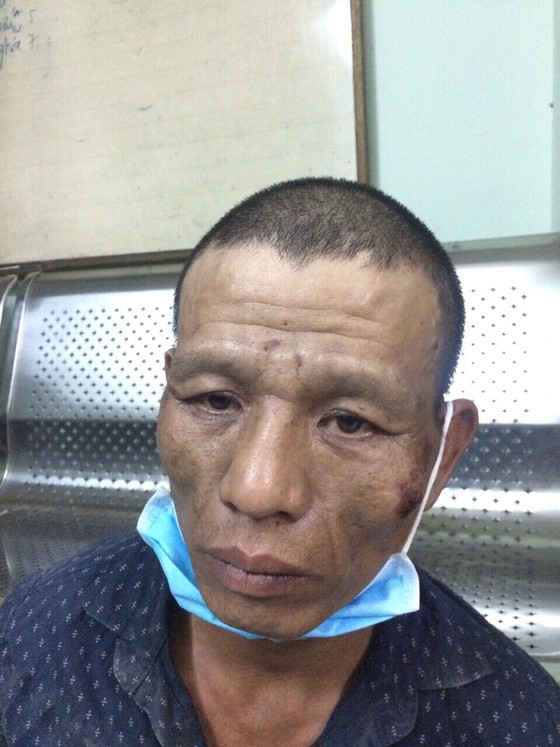 Hai tên cướp mang tiền án dùng dao chống trả trinh sát hình sự đặc nhiệm khi bị truy đuổi ảnh 5