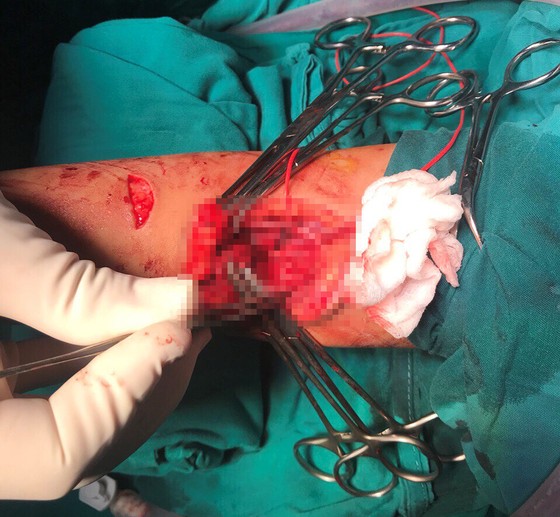 Bé gái rơi từ tầng 7 xuống đất bị đa chấn thương được cứu sống ngoạn mục ảnh 1