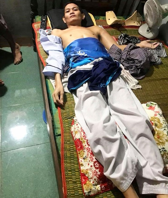 Khốn khó vì bệnh ung thư xương ảnh 1