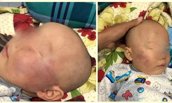 Cho thôi việc bảo mẫu tát bé trai 19 tháng tuổi đến sưng mặt ảnh 1