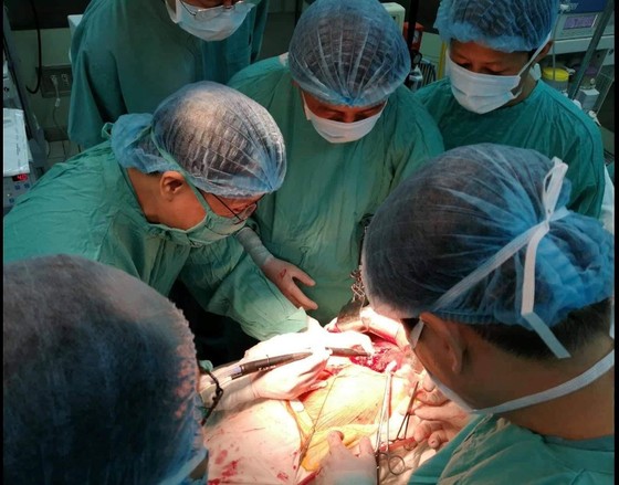 Lần đầu cắt gan bằng kỹ thuật bảo tồn ở Bệnh viện Trung ương Huế ảnh 1