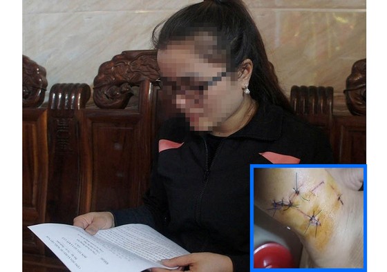 Một cán bộ quản lý thị trường bị “tố” đánh người nhập viện ảnh 1