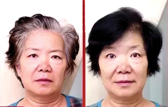 Phương thức mới giúp tóc đen mọc trở lại ảnh 1