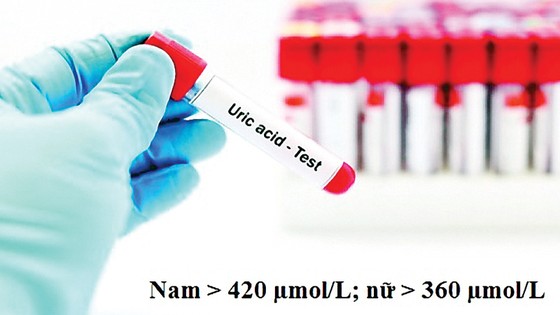 Chỉ số acid uric cao, sưng, đau do Gút làm thế nào để bớt tái phát? ảnh 1
