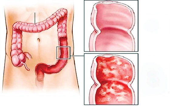 Sống thọ, sống khỏe, sao không? ảnh 3
