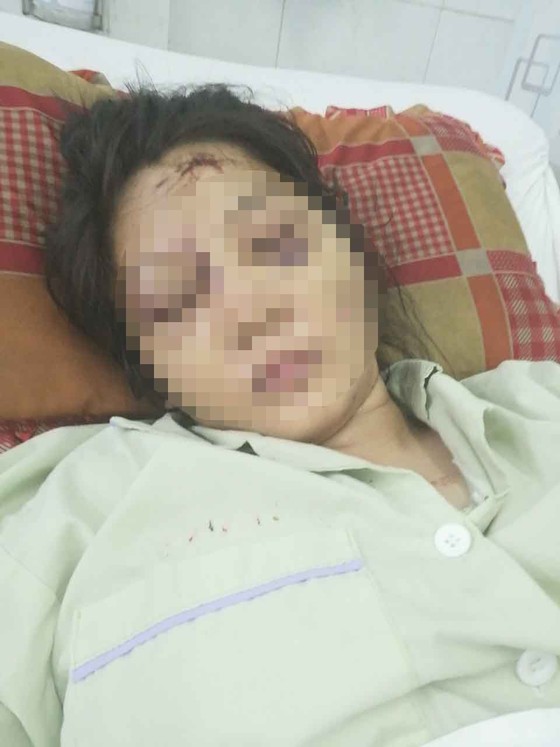 Bắt đối tượng cuối cùng trong vụ bắt cóc, tra tấn thai phụ đến sẩy thai ảnh 2
