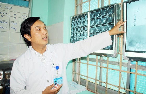 Bình Định: Cứu chữa kịp thời một bệnh nhân nhồi máu não ảnh 1