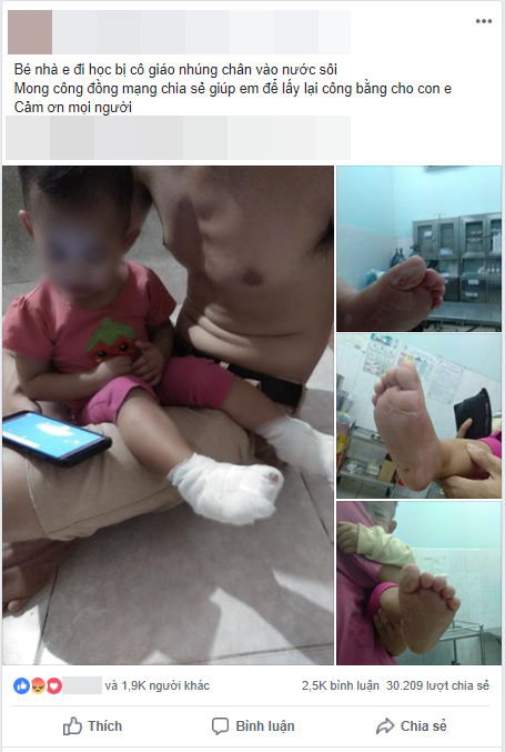 Tạm đình chỉ cơ sở giữ trẻ khiến bé gái 18 tháng tuổi phỏng nước sôi ảnh 1