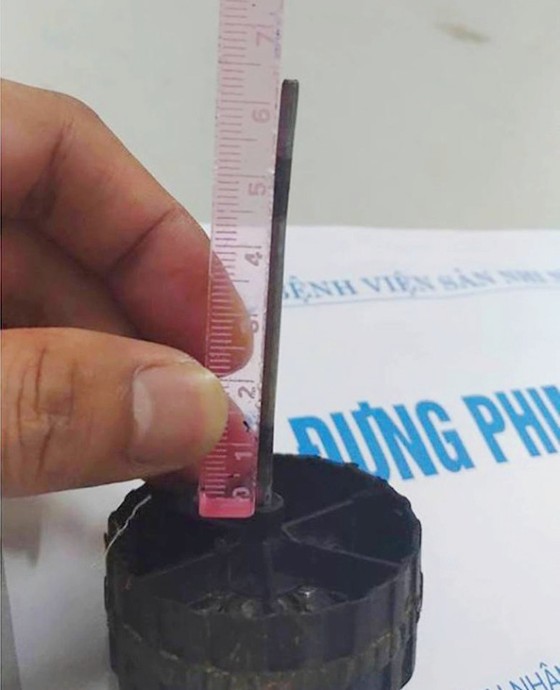 Bé 11 tháng bị que thép xe đồ chơ xuyên vào đầu ảnh 2