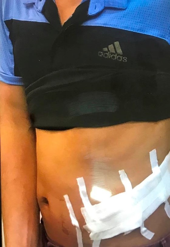 Police unearth kidney trade ring reaping tens of billions of Vietnam dong ảnh 1