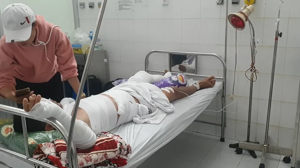  Nổ ghe lưới ghẹ ở Cà Mau, 3 người bị bỏng nặng