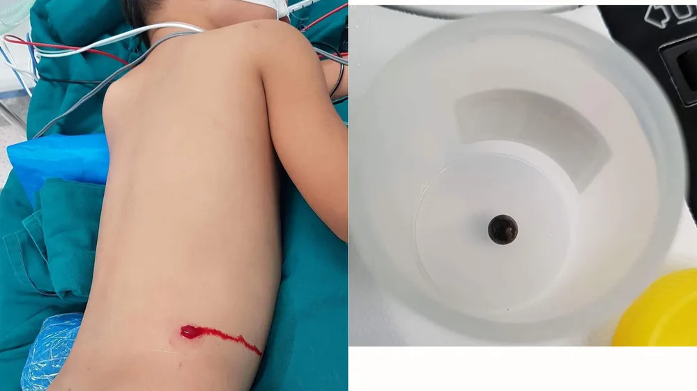 Các bác sĩ đang tiến hành phẫu thuật