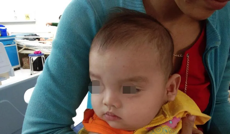 Đến nay, sức khỏe bé đã ổn định, bé được xuất viện với gương mặt lành lặn 