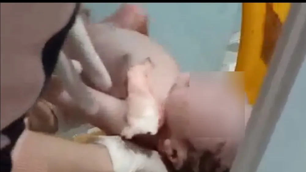 Bé trai sơ sinh được lấy ra từ thùng rác bệnh viện