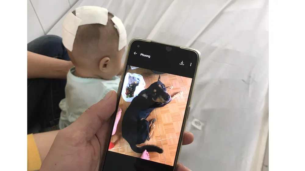 Bé gái sau khi được phẫu thuật