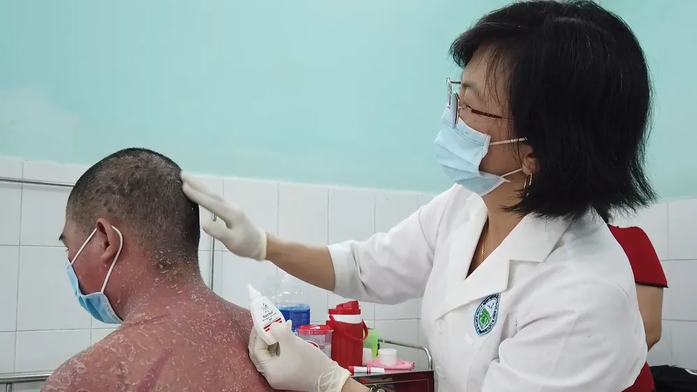 Bác sĩ đang chăm sóc và điều trị cho bệnh nhân bị vảy nến