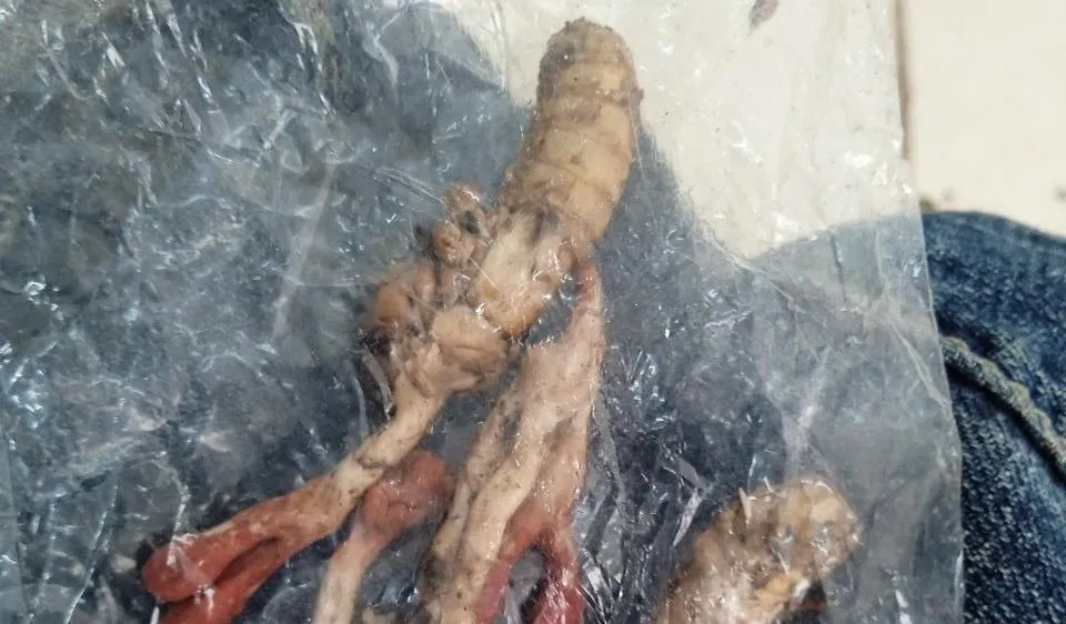 Thêm một trường hợp ngộ độc do ăn nấm ký sinh trên xác ve sầu 