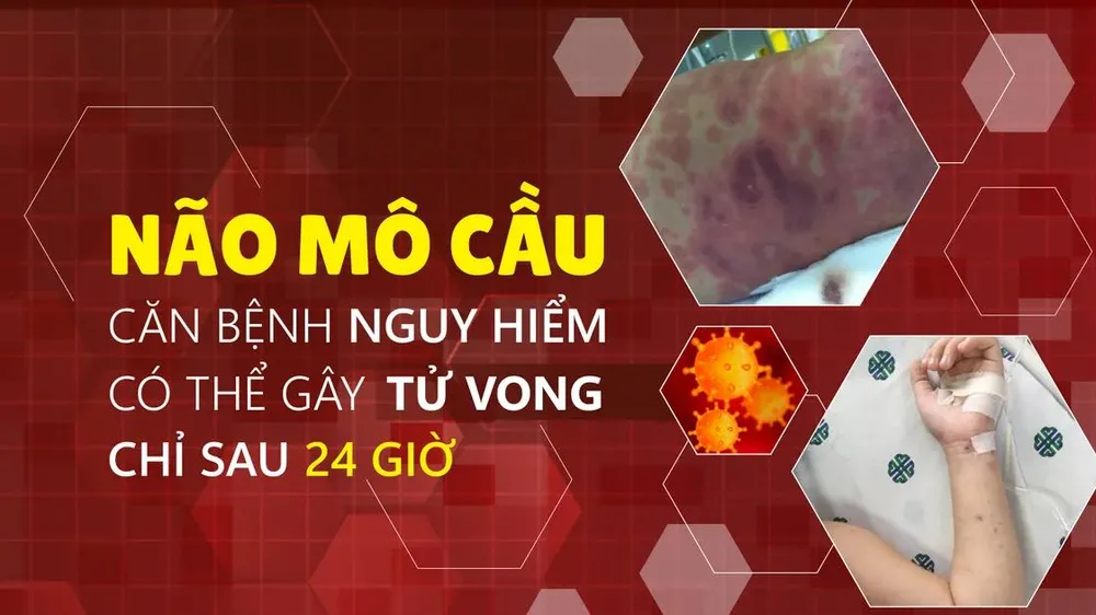 TPHCM: Ghi nhận ca bệnh do não mô cầu tại xã Thường Tân
