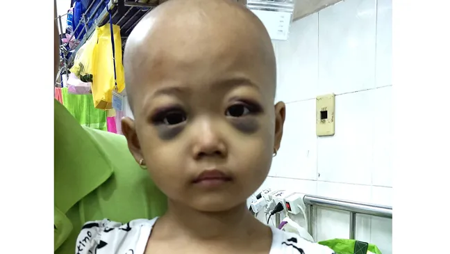 Cháu bé 4 tuổi mắc bệnh hiểm nghèo