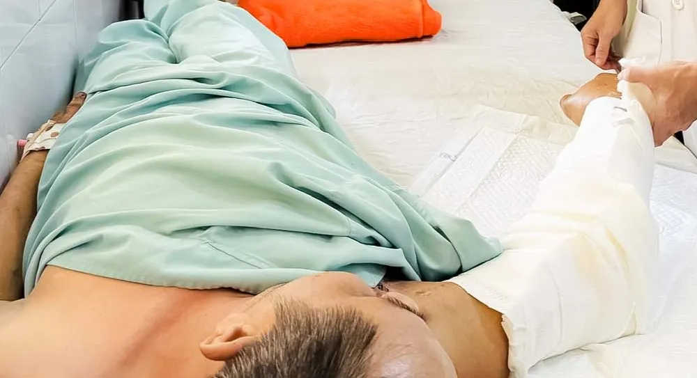 Nối thành công cánh tay bị đứt lìa cho nam bệnh nhân. Ảnh: BVCC