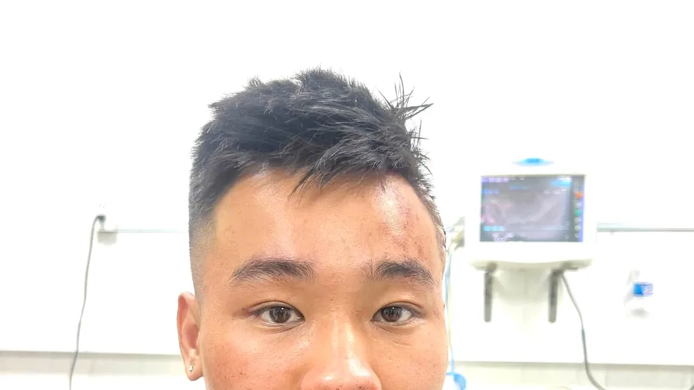 Đối tượng Nguyễn Đức Anh. Ảnh: CA TPĐN cung cấp