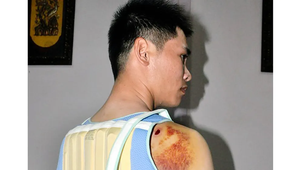 Khởi tố con trai bí thư đảng ủy xã dùng súng điện bắn người