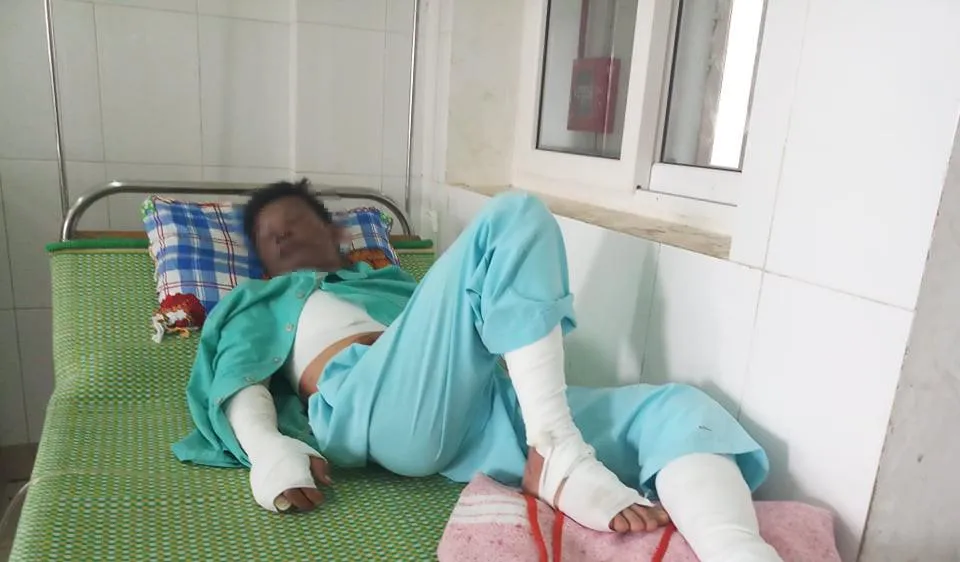 Anh Y. đang được điều trị tại Bệnh viện đa khoa tỉnh Quảng Trị