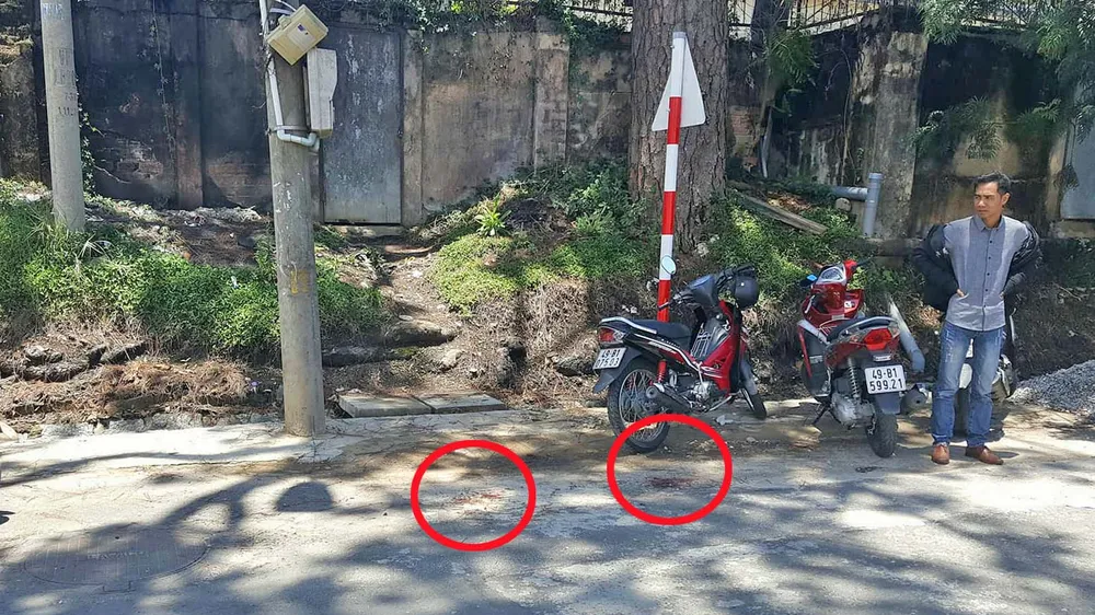 Vật nghi lựu đạn phát nổ, người phụ nữ bị nát bàn tay