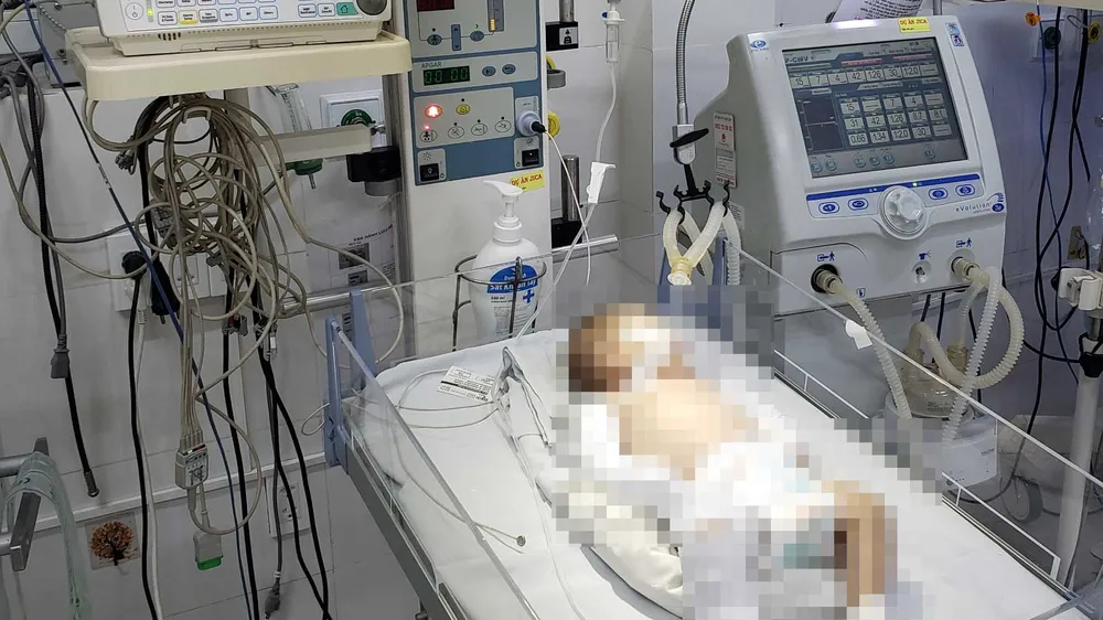 Bé sơ sinh 2 tháng tuổi nghi bị bạo hành nhập viện trong tình trạng nguy kịch