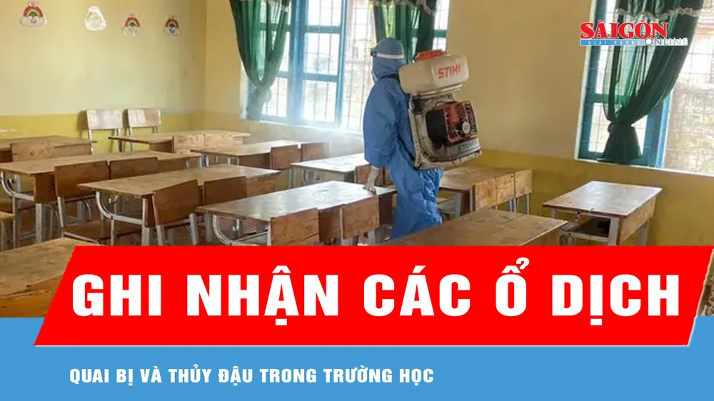 Đắk Lắk: Ghi nhận các ổ dịch quai bị và thủy đậu trong trường học 